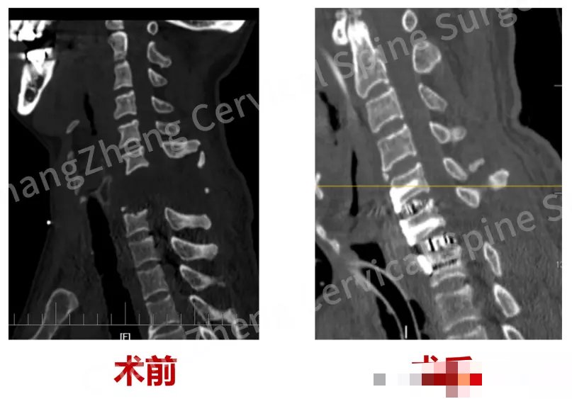 【资讯】难度堪比登天！中国医生救回“身首离断”伤者-爱乐享资源网