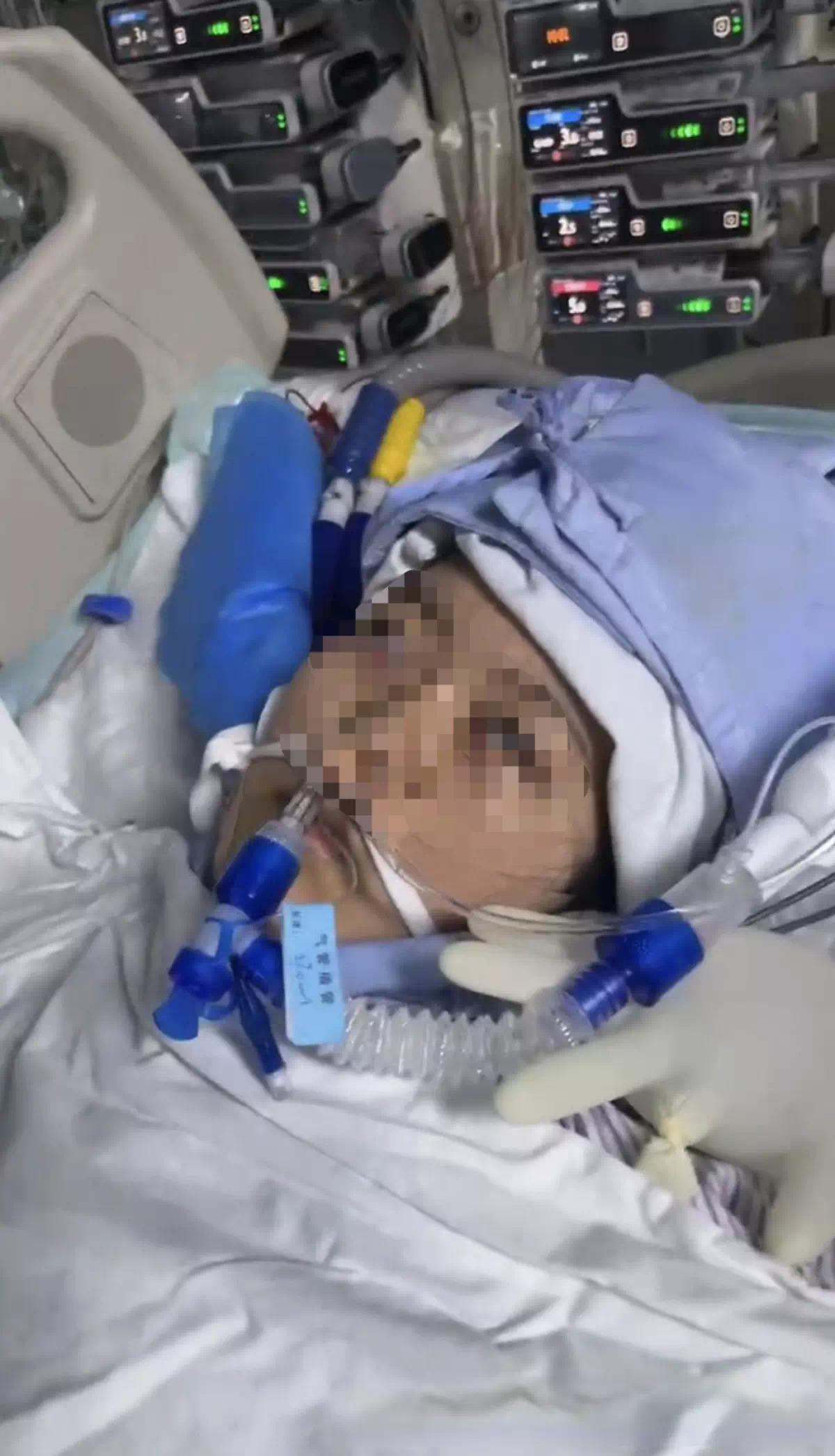 【资讯】22岁美甲师手术成功却在复苏室脑死亡-爱乐享资源网