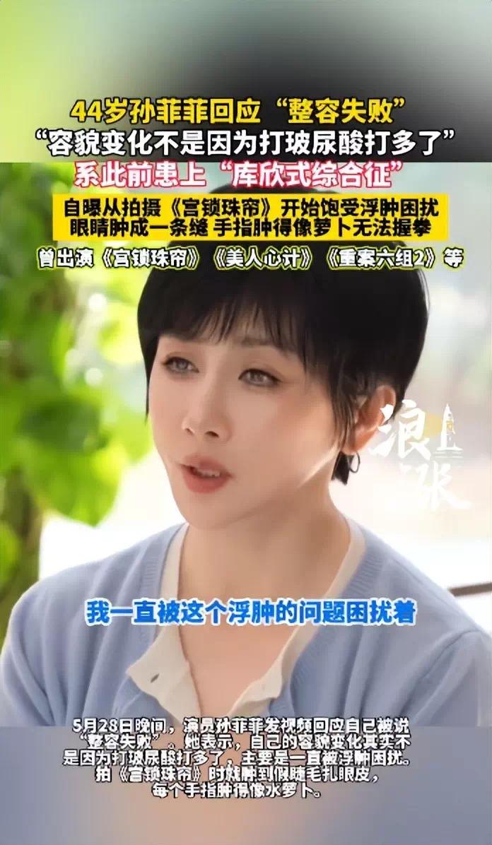 【资讯】知名女演员回应“整容失败”：是患“库欣式综合征-爱乐享资源网